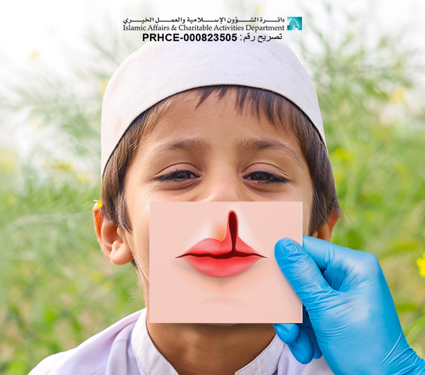 Cleft Lip Surgery in Pakistan